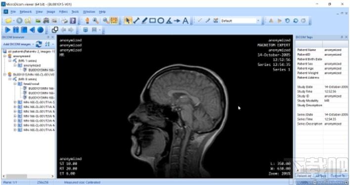 MicroDicom viewer下载,Dicom格式看图软件,图片浏览,看图软件