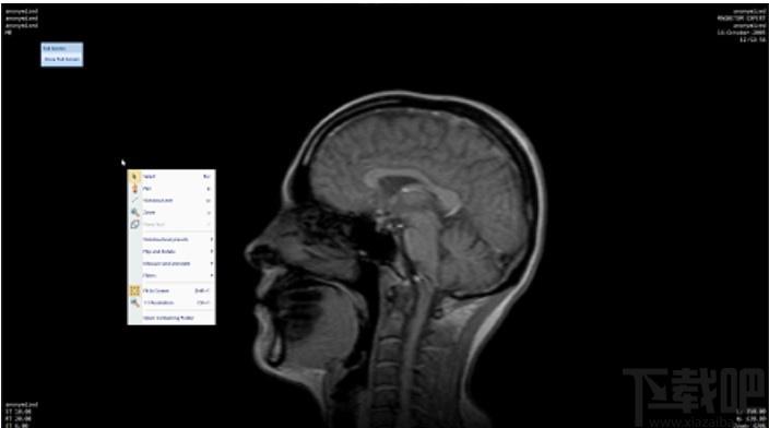 MicroDicom viewer下载,Dicom格式看图软件,图片浏览,看图软件