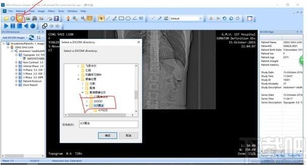 MicroDicom viewer下载,Dicom格式看图软件,图片浏览,看图软件