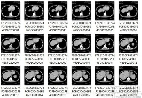 MicroDicom viewer下载,Dicom格式看图软件,图片浏览,看图软件