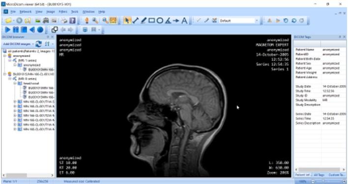 MicroDicom viewer下载,Dicom格式看图软件,图片浏览,看图软件