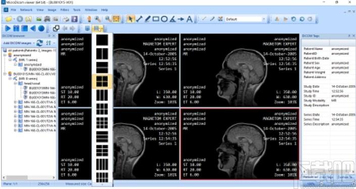 MicroDicom viewer下载,Dicom格式看图软件,图片浏览,看图软件