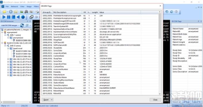 MicroDicom viewer下载,Dicom格式看图软件,图片浏览,看图软件