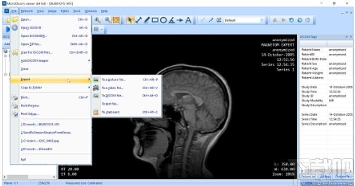 MicroDicom viewer下载,Dicom格式看图软件,图片浏览,看图软件