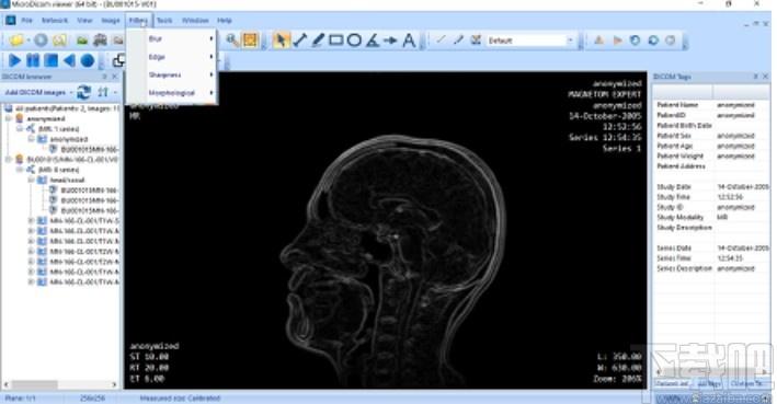 MicroDicom viewer下载,Dicom格式看图软件,图片浏览,看图软件